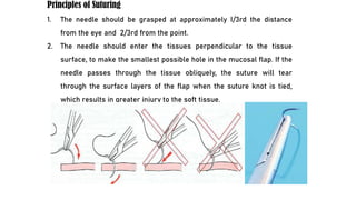 Principles of Suturing
1. The needle should be grasped at approximately I/3rd the distance
from the eye and 2/3rd from the point.
2. The needle should enter the tissues perpendicular to the tissue
surface, to make the smallest possible hole in the mucosal flap. If the
needle passes through the tissue obliquely, the suture will tear
through the surface layers of the flap when the suture knot is tied,
which results in greater injury to the soft tissue.
 