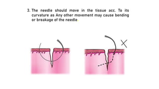 3. The needle should move in the tissue acc. To its
curvature as Any other movement may cause bending
or breakage of the needle.
 