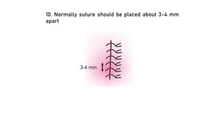 10. Normally suture should be placed about 3-4 mm
apart
 