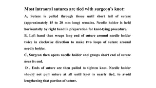 Most intraoral sutures are tied with surgeon’s knot:
A, Suture is pulled through tissue until short tail of suture
(approximately 15 to 20 mm long) remains. Needle holder is held
horizontally by right hand in preparation for knot-tying procedure.
B, Left hand then wraps long end of suture around needle holder
twice in clockwise direction to make two loops of suture around
needle holder.
C, Surgeon then opens needle holder and grasps short end of suture
near its end.
D , Ends of suture are then pulled to tighten knot. Needle holder
should not pull suture at all until knot is nearly tied, to avoid
lengthening that portion of suture.
 