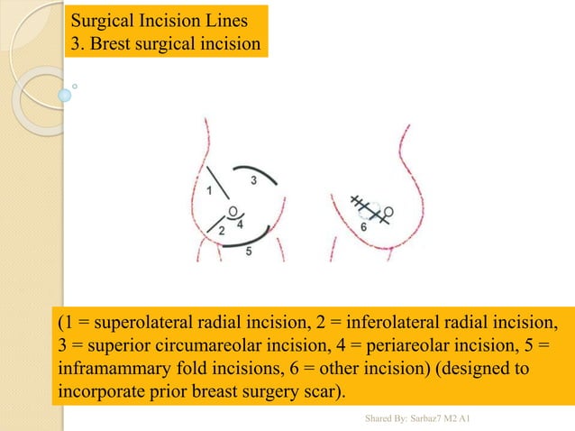 Sutures, Incisions and Mesh.ppt
