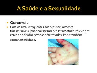 A Saude e a sexualidadeDoenças sexualmente transmissíveis, são doenças que se transmitem essencialmente (mas também não é a única forma) pelo contacto sexual. O uso de preservativo tem sido considerado como a medida mais eficiente para prevenir a contaminação e impedir sua contaminação. Mas o preservativo não é um método totalmente seguro.A saúde e a SexualidadeO uso do preservativo as vantagens e desvantagens; Vantagens:É cómodo e fácil de colocar;É bastante eficaz;Não é caro;Fácil aquisição.