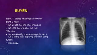 SUYỄN
Nam, 11 tháng, nhập viện vì thở mệt
Bệnh 3 ngày:
• N1-2: Sốt, ho, khó khè, không ọc
• N3: Sốt, ho, khò khè, thở mệt
Tiền căn:
• Ho khò khè lần 1 lúc 6 tháng tuổi, lần 2
lúc 9 tháng tuổi, đáp ứng phun khí dung
Khám:
• Ran ngáy.
 