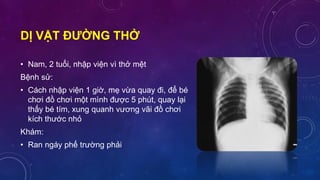 DỊ VẬT ĐƯỜNG THỞ
• Nam, 2 tuổi, nhập viện vì thở mệt
Bệnh sử:
• Cách nhập viện 1 giờ, mẹ vừa quay đi, để bé
chơi đồ chơi một mình được 5 phút, quay lại
thấy bé tím, xung quanh vương vãi đồ chơi
kích thước nhỏ
Khám:
• Ran ngáy phế trường phải
 
