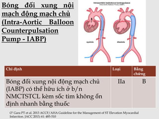 Chỉ định Loại Bằng
chứng
Bóng đối xung nội động mạch chủ
(IABP) có thể hữu ích ở b/n
NMCTSTCL kèm sốc tim không ổn
định nhanh bằng thuốc
IIa B
O’ Gara PT et al. 2013 ACCF/AHA Guideline for the Management of ST Elevation Myocardial
Infarction. JACC 2013; 61: 485-510
Bóng đối xung nội
mạch động mạch chủ
(Intra-Aortic Balloon
Counterpulsation
Pump - IABP)
 