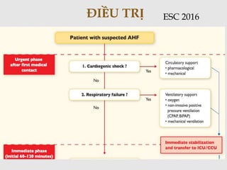 ĐIỀU TRỊ ESC 2016
 