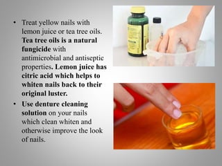 • Treat yellow nails with
lemon juice or tea tree oils.
Tea tree oils is a natural
fungicide with
antimicrobial and antiseptic
properties. Lemon juice has
citric acid which helps to
whiten nails back to their
original luster.
• Use denture cleaning
solution on your nails
which clean whiten and
otherwise improve the look
of nails.
 