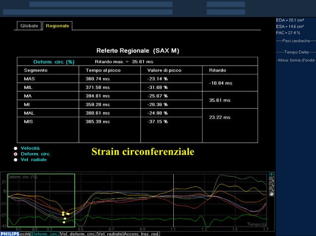 Stenosi Valvolare Aortica SVA Valutazione Ecocardiografica PPT stenosi-valvolare-aortica-sva-valutazione-ecocardiografica-ppt