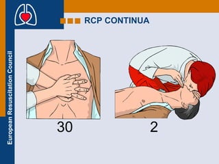 RCP CONTINUA   30 2 