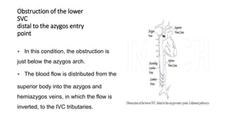 Obstruction of the lower
SVC
distal to the azygos entry
point
 In this condition, the obstruction is
just below the azygos arch.
 The blood flow is distributed from the
superior body into the azygos and
hemiazygos veins, in which the flow is
inverted, to the IVC tributaries.
 