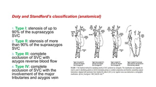 Doty and Standford’s classification (anatomical)
1. Type I: stenosis of up to
90% of the supraazygos
SVC
2. Type II: stenosis of more
than 90% of the supraazygos
SVC
3. Type III: complete
occlusion of SVC with
azygos reverse blood flow
4. Type IV: complete
occlusion of SVC with the
involvement of the major
tributaries and azygos vein
 