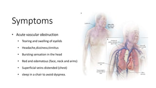 Symptoms
• Acute vascular obstruction
• Tearing and swelling of eyelids
• Headache,dizziness,tinnitus
• Bursting sensation in the head
• Red and edematous (face, neck and arms)
• Superficial veins distended (chest)
• sleep in a chair to avoid dyspnea.
 