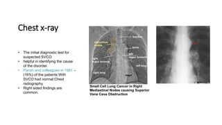 Chest x-ray
• The initial diagnostic test for
suspected SVCO.
• helpful in identifying the cause
of the disorder.
• Parish and colleagues in 1981 –
(16%) of the patients With
SVCO had normal Chest
radiography.
• Right sided findings are
common.
 