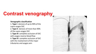 Contrast venography
Venographic classification
1. Type I: stenosis of up to 90% of the
supra-azygos SVC
2. Type II: stenosis of more than 90%
of the supra-azygos SVC
3. Type III: complete occlusion of SVC
with azygos reverse blood flow
4. Type IV: complete occlusion of SVC
with the involvement of the major
tributaries and azygos vein
 