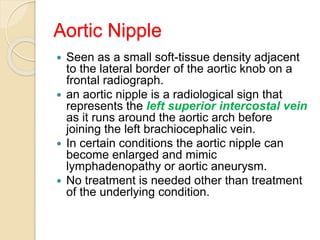 Aortic Nipple
 Seen as a small soft-tissue density adjacent
to the lateral border of the aortic knob on a
frontal radiograph.
 an aortic nipple is a radiological sign that
represents the left superior intercostal vein
as it runs around the aortic arch before
joining the left brachiocephalic vein.
 In certain conditions the aortic nipple can
become enlarged and mimic
lymphadenopathy or aortic aneurysm.
 No treatment is needed other than treatment
of the underlying condition.
 