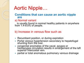 Aortic Nipple…
Conditions that can cause an aortic nipple
are
a) Normal variant
is usually found in normal healthy patients in anywhere
from 1.4-9.5% of people.
b) Increase in venous flow such as
 Recumbant position, or during expiration
 Portal venous hypertension secondary to hepatofugal
shunting from the liver,
 congenital anomalies of the caval, azygos or
hemiazygos circulation results in enlargement of the left
superior intercostal vein.
 partial or total anomalous pulmonary venous drainage
 