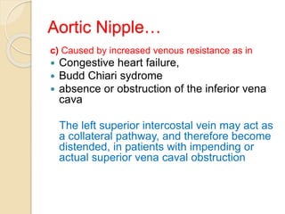 Aortic Nipple…
c) Caused by increased venous resistance as in
 Congestive heart failure,
 Budd Chiari sydrome
 absence or obstruction of the inferior vena
cava
The left superior intercostal vein may act as
a collateral pathway, and therefore become
distended, in patients with impending or
actual superior vena caval obstruction
 