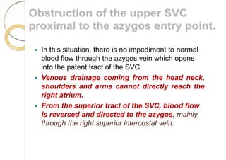  In this situation, there is no impediment to normal
blood flow through the azygos vein which opens
into the patent tract of the SVC.
 Venous drainage coming from the head neck,
shoulders and arms cannot directly reach the
right atrium.
 From the superior tract of the SVC, blood flow
is reversed and directed to the azygos, mainly
through the right superior intercostal vein.
 