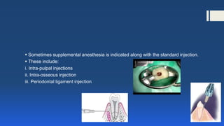  Sometimes supplemental anesthesia is indicated along with the standard injection.
 These include:
i. Intra-pulpal injections
ii. Intra-osseous injection
iii. Periodontal ligament injection
 