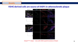 SVEP1 role in inflammation and atherosclerosis.pptx