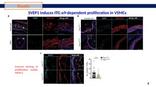 SVEP1 role in inflammation and atherosclerosis.pptx