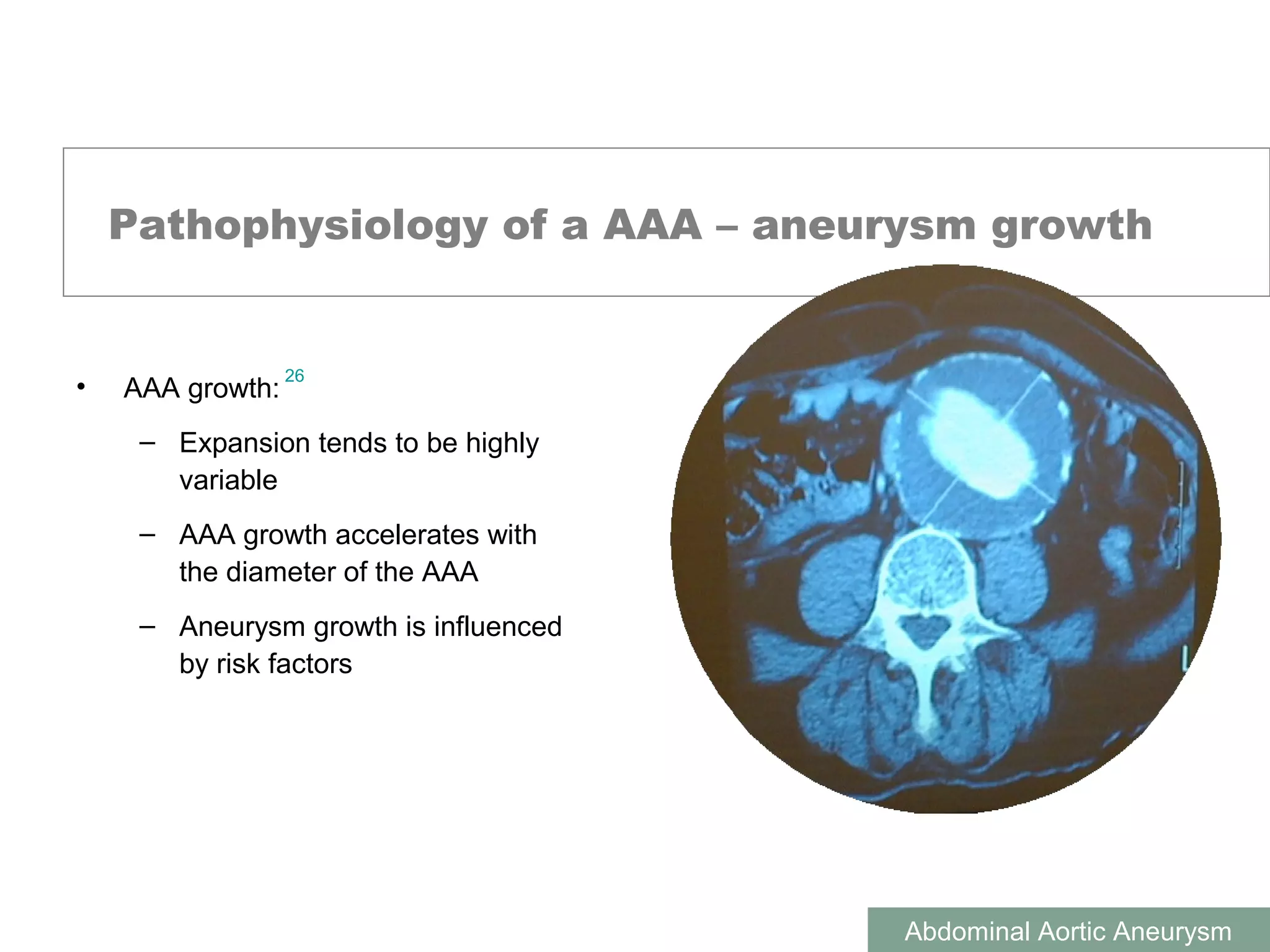 Abdominal Aortic Aneurysm | PPT
