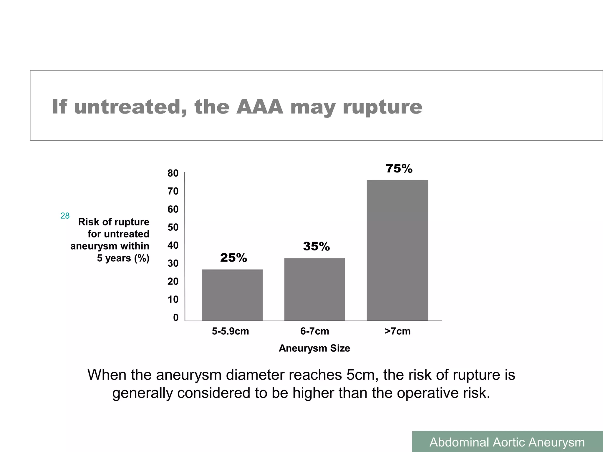 Abdominal Aortic Aneurysm | PPT