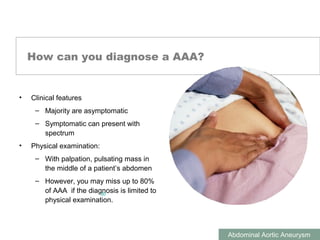ABDOMINAL AORTIC ANEURYSMS
Abdominal Aortic Aneurysm
How can you diagnose a AAA?
• Clinical features
– Majority are asymptomatic
– Symptomatic can present with
spectrum
• Physical examination:
– With palpation, pulsating mass in
the middle of a patient’s abdomen
– However, you may miss up to 80%
of AAA if the diagnosis is limited to
physical examination.
30
 