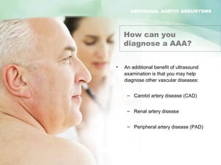 ABDOMINAL AORTIC ANEURYSMS
Abdominal Aortic Aneurysm
How can you
diagnose a AAA?
• An additional benefit of ultrasound
examination is that you may help
diagnose other vascular diseases:
– Carotid artery disease (CAD)
– Renal artery disease
– Peripheral artery disease (PAD)
ABDOMINAL AORTIC ANEURYSMS
 