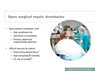 ABDOMINAL AORTIC ANEURYSMS
Abdominal Aortic Aneurysm
Open surgical repair: drawbacks
• Many patients considered “unfit” :
– High anesthesia risk
– Significant co-morbidities
– Previous abdominal
surgery/hostile abdomen
• Difficult recovery for patient:
– Risks losing independence
– High perioperative morbidity
– 5% risk of mortality
41
41
42
 