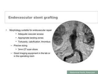 ABDOMINAL AORTIC ANEURYSMS
Abdominal Aortic Aneurysm
Endovascular stent grafting
• Morphology suitable for endovascular repair
• Adequate vascular access
• Appropriate landing zones
• Tortuosity, calcification, thrombus
– Precise sizing
• 3mm CT scan slices
– Good imaging equipment in the lab or
in the operating room
 