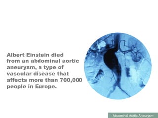 ABDOMINAL AORTIC ANEURYSMS
Abdominal Aortic Aneurysm
Albert Einstein died
from an abdominal aortic
aneurysm, a type of
vascular disease that
affects more than 700,000
people in Europe.
 