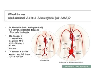 ABDOMINAL AORTIC ANEURYSMS
Abdominal Aortic Aneurysm
What is an
Abdominal Aortic Aneurysm (or AAA)?
Normal aorta
Aorta with an abdominal aneurysm
• An Abdominal Aortic Aneurysm (AAA)
is a permanentlocalized dilatation
of the abdominal aorta.
• The disorder is
conventionally
diagnosed if the
aortic diameter is
30 mm
or more.
• Or increase in size of
Vessel 1 and half times
normal diameter
1
 