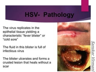 Herpesviridae Presentation | PPT
