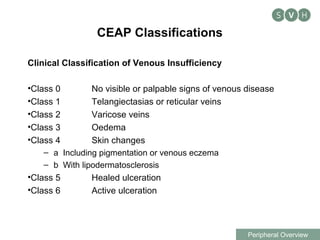 Ceap Classification Numbers Determining a vascular cause for leg pain and referrals | PPT