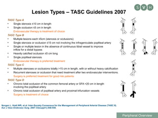 Assessment of leg ulcers and advances in endovascular treatment | PPT