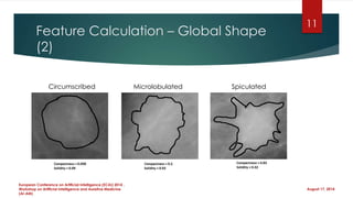 Feature Calculation – Global Shape
(2)
August 17, 2014
European Conference on Artificial Intelligence (ECAI) 2014 ,
Workshop on Artificial Intelligence and Assistive Medicine
(AI-AM)
Circumscribed Microlobulated Spiculated
11
 