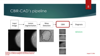 CBIR-CAD’s pipeline
August 17, 2014
European Conference on Artificial Intelligence (ECAI) 2014 ,
Workshop on Artificial Intelligence and Assistive Medicine
(AI-AM)
Lesion
Segmentation
Mass
Detection
CBIR Diagnosis
Input
Image
BENIGN
8
 
