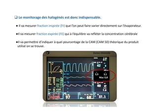  Le monitorage des halogénés est donc indispensable.
● Il va mesurer fraction inspirée (FI) que l’on peut faire varier directement sur l’évaporateur.
●Il va mesurer fraction expirée (FE) qui à l’équilibre va refléter la concentration cérébrale
●Il va permettre d’indiquer à quel pourcentage de la CAM (CAM 50) théorique du produit
utilisé on se trouve.
3,9 3,1
Mac 0,8
S
E
V
FE FI
 