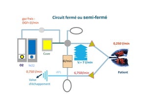 Valve
d’échappement
0,250 l/min
Circuit fermé ou semi-fermé
Patient
O2 NO2
Cuve
gaz frais :
DGF=1l/min
0,750 l/min
VE= 7 l/min
APL
6l/min
6,750l/min
 