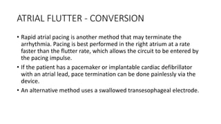SUPRAVENTRICULAR TACHYCARDIA - SVT | PPTX