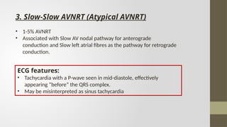 All you want to know about SVT in brief .pptx
