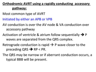 Pathway Apb SVT-Alogarythm | PPT