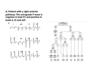 Svt Algorithm Rp Interval SVT-Alogarythm | PPT