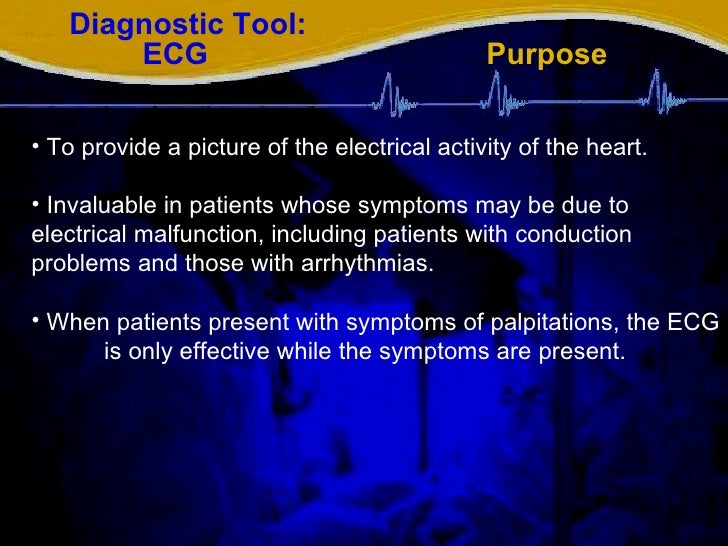 The ECG as a Diagnostic Tool A Clinical Case Study of Supraventricul…