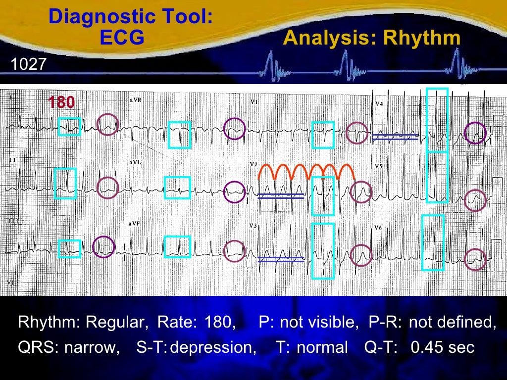 totalcardiagnostics vcds download totalcardiagnostics vcds download
