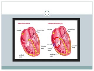 Svt and vm | PPT
