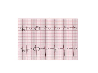 Svt Rcem Svt evaluation | PPTX