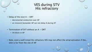 VES during STV
His refractory
• Delay of the next A = ORT
• decremental conduction over AP
• an innocent bystander AP can not delay A during AT
• Termination of SVT without an A = ORT
• VA block in AP
• Note, even a well timed His refractory VES may not affect the atrial activation if the
stim is far from the site of AP
 