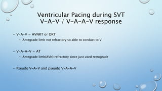 • V-A-V = AVNRT or ORT
• Antegrade limb not refractory so able to conduct to V
• V-A-A-V = AT
• Antegrade limb(AVN) refractory since just used retrograde
• Pseudo V-A-V and pseudo V-A-A-V
Ventricular Pacing during SVT
V-A-V / V-A-A-V response
 
